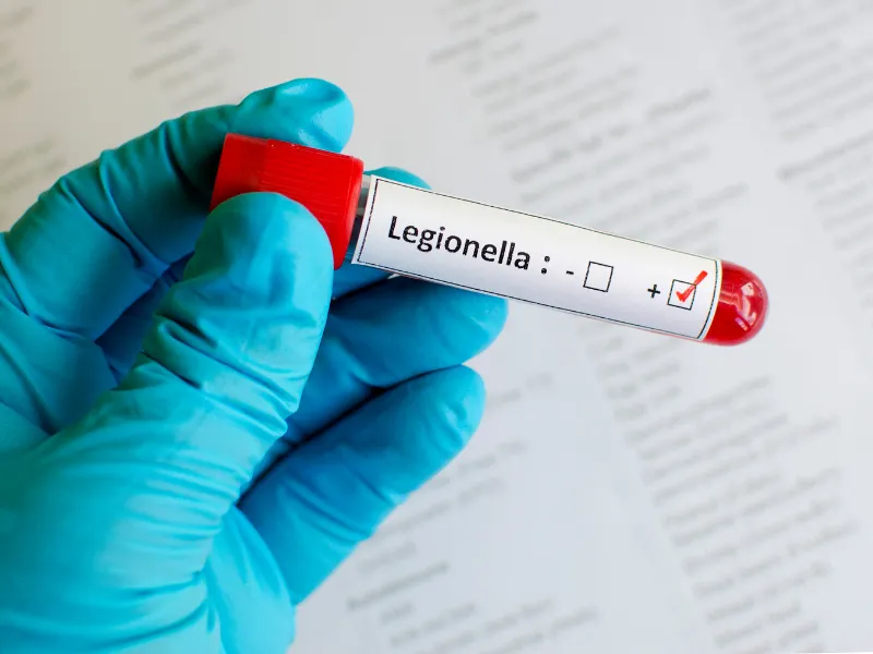 Próbka laboratoryjna z legionellą. Źródło: canva.com
