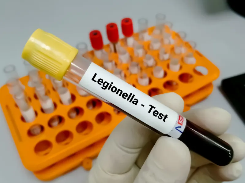Legionella - testy laboratoryjne