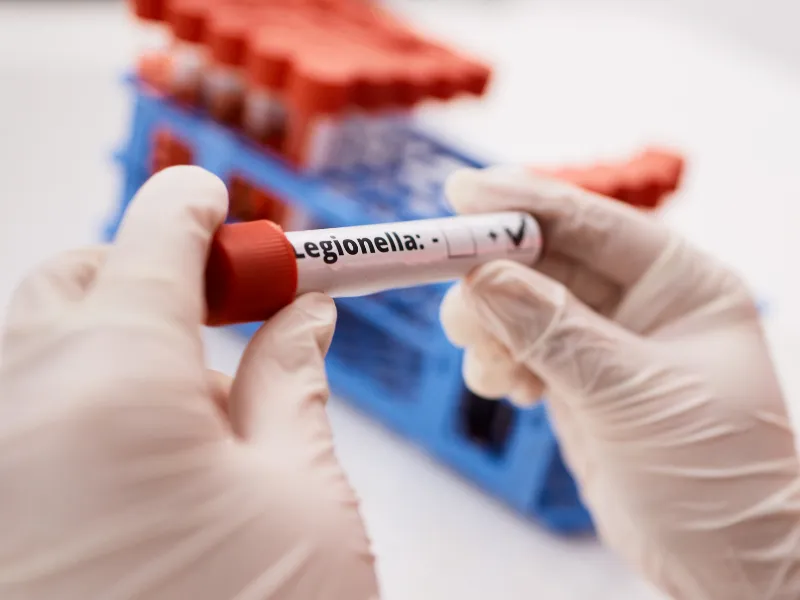 Legionella - testy laboratoryjne